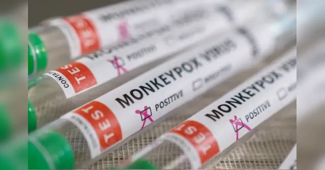 Imagem ilustrativa da notícia Entenda o surto de mpox na África que preocupa a OMS