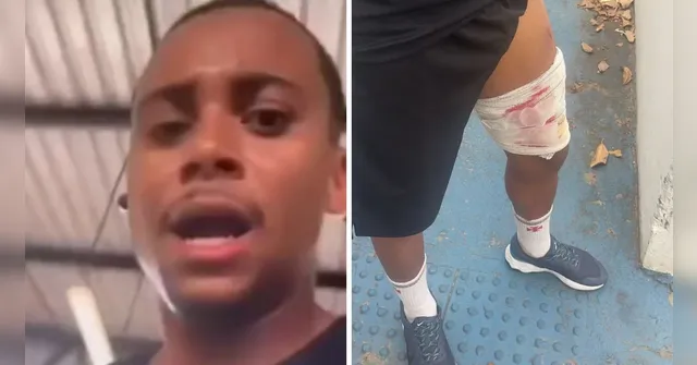 Imagem ilustrativa da notícia Cenas fortes! Corredor é baleado na perna durante corrida