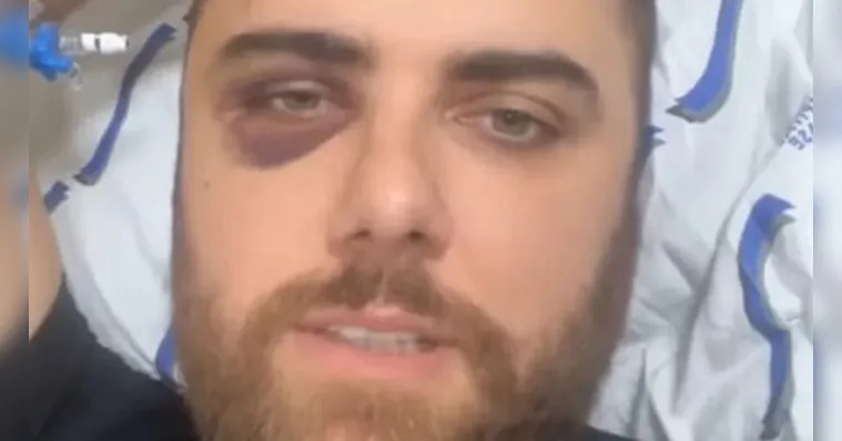Imagem ilustrativa da notícia Zé Neto atualiza estado de saúde e mostra hematoma no olho