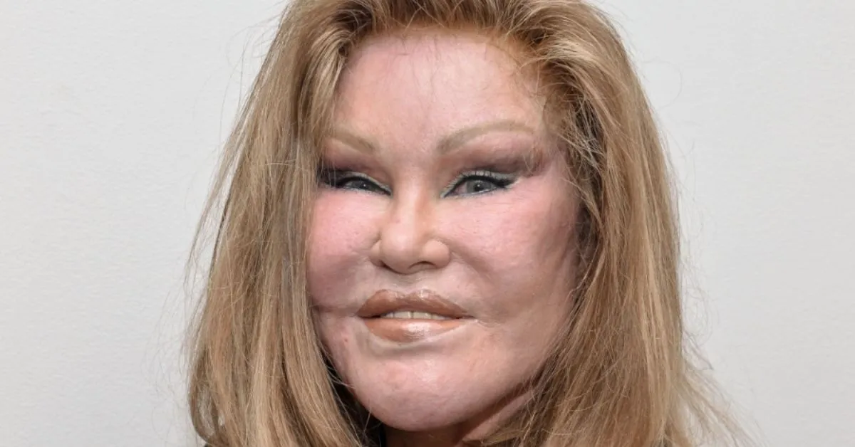 Jocelyn Wildenstein ficou famosa pelos traços felinos após uma série de procedimentos estéticos.