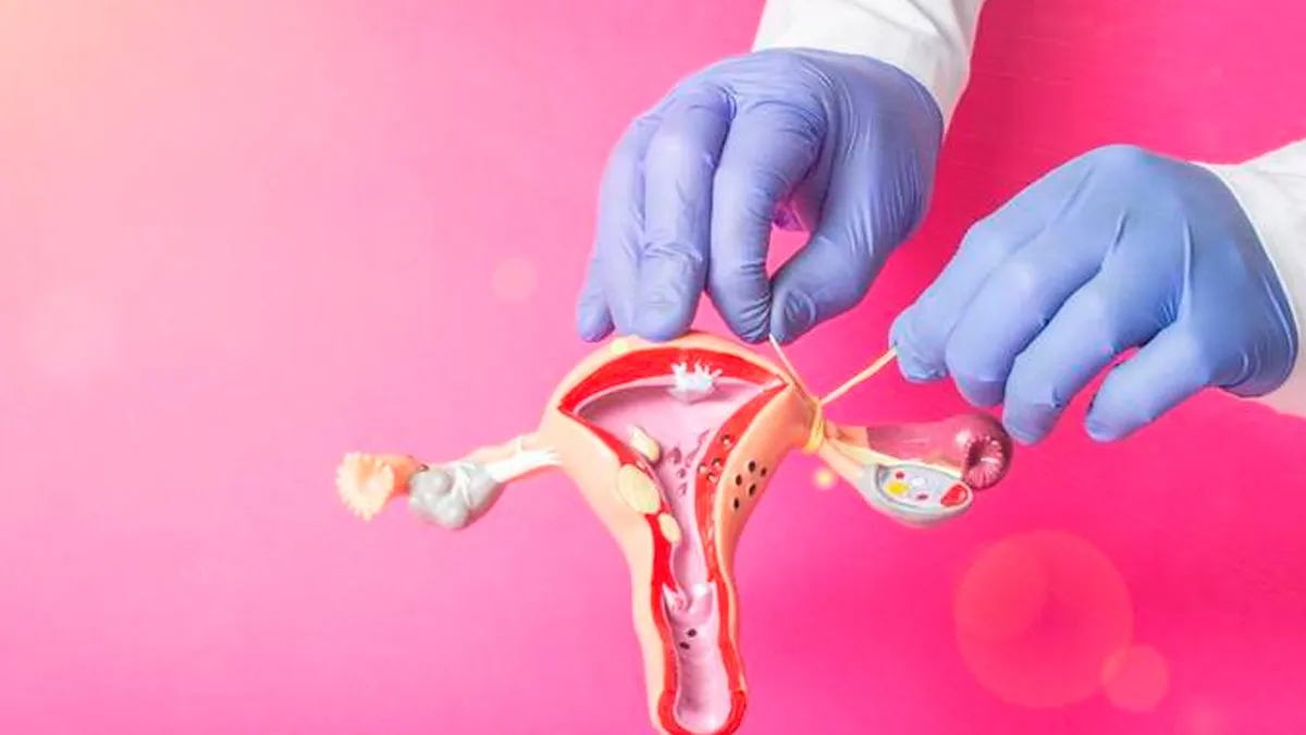 Imagem ilustrativa da notícia Laqueadura e vasectomia podem ser feitos sem autorização