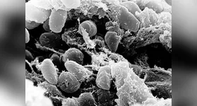 Imagens da bactéria Yersinia pestis causadora da peste negra