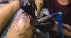 Dermatologista recomenda a remoção de tatuagens com tratamento a laser, levando em conta fatores como o tamanho da tatuagem, sua localização na pele e as cores utilizadas.