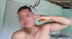 Homem ficou com tesoura cravada na cabeça em Pancas.