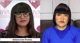 Vítima de escalpelamento, Anny Almeida teve um vídeo divulgado indevidamente pelo candidato Éder Mauro (na esquerda) em sua campanha eleitoral.