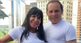 Esdras de Souza, marido de Gretchen, revelou como era a aparência antes de fazer procedimentos estéticos