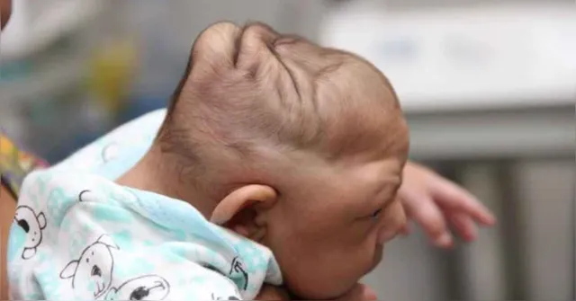 Imagem ilustrativa da notícia Crianças afetadas pelo zika vão receber apoio de R$ 60 mil