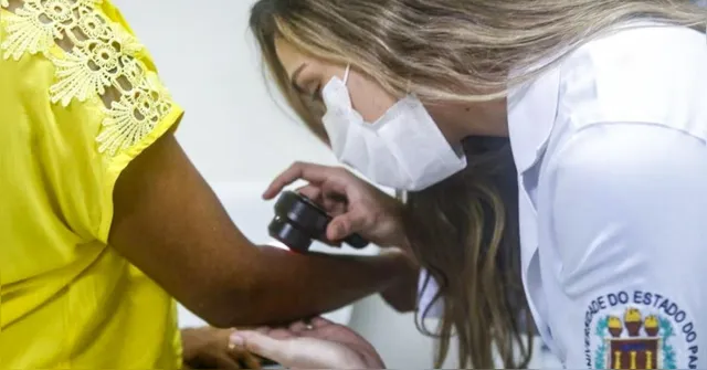 Imagem ilustrativa da notícia Uepa faz consultas dermatológicas de graça neste sábado