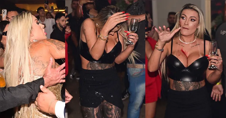 Imagem ilustrativa da notícia Sangue: Andressa Urach leva corte profundo no rosto após briga em festa