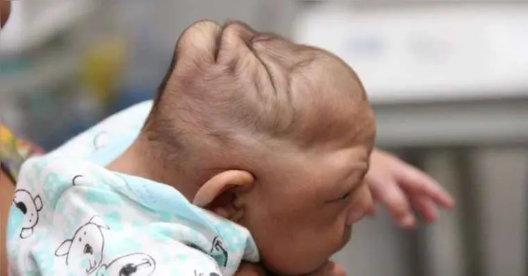 Imagem ilustrativa da notícia Crianças afetadas pelo zika vão receber apoio de R$ 60 mil
