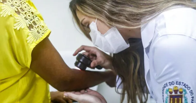 Imagem ilustrativa da notícia Uepa faz consultas dermatológicas de graça neste sábado