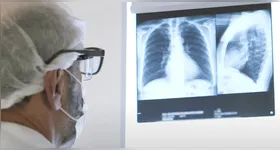 Pneumonia: aumento de casos da doença ascende alerta no Pará. Saiba os sintomas e como se proteger!