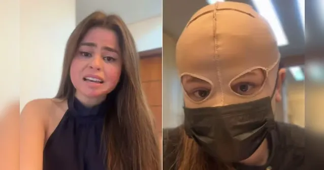 Imagem ilustrativa da notícia Médica teve queimaduras de 2° grau com peeling de ATA; veja