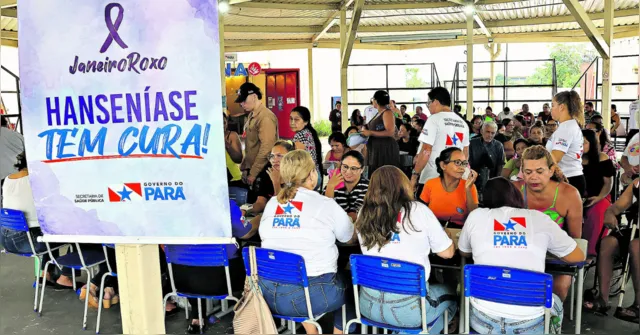 Imagem ilustrativa da notícia Combate à hanseníase: detecção precoce é fundamental 
