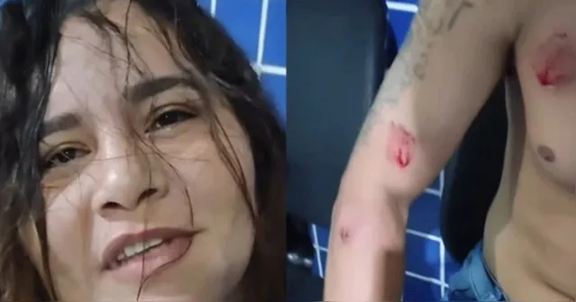 Imagem ilustrativa da notícia Mulher flagra traição, perde o controle e morde marido e amante