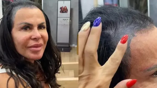 Imagem ilustrativa da notícia Com alopecia, Gretchen grava vídeo sem mega hair