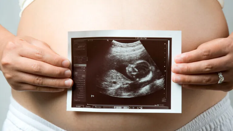 Mulheres grávidas em Belém podem realizar ultrassonografias gratuitas em junho. Saiba como!