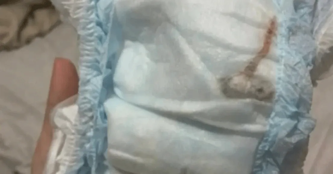 Camundongo estava entre as camadas da fralda, indicando que fato ocorreu durante etapa de fabricação