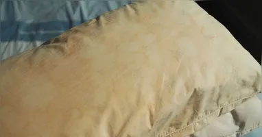 Travesseiro ficam amarelados com o uso constante.