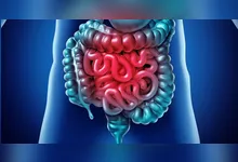 Imagem ilustrativa da notícia Saiba quando o desconforto intestinal é sinal de alerta