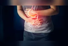 Especialista tira as dúvidas do leitor e ouvinte do DOL em mais uma edição do Dr. Responde