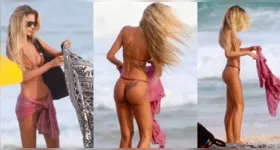 A luta de Yasmin Brunet contra o lipedema e a intolerância ao glúten