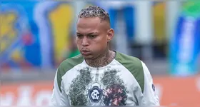 Atacante terminou o jogo contra o Volta Redonda lesionado