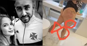 Larissa publicou fotos com marcas no corpo
