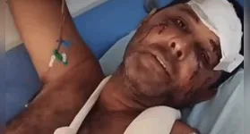 Homem ficou acamado após ataque do felino
