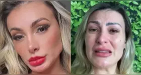 Em meio a uma crise de saúde mental, Andressa Urach rompe o silêncio nas redes e revela motivos do afastamento.