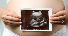 Mulheres grávidas em Belém podem realizar ultrassonografias gratuitas em junho. Saiba como!