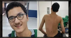 Com paralisia cerebral e escoliose grave, Samuel Cecim precisa de ajuda para cirurgia em SP.