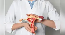 Saiba mais sobre o câncer de ovário, seus sintomas, fatores de risco e a importância da prevenção e diagnóstico precoce.