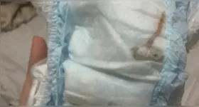 Camundongo estava entre as camadas da fralda, indicando que fato ocorreu durante etapa de fabricação