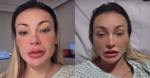 Imagem ilustrativa da notícia Após ser internada, Andressa Urach revela diagnóstico de doença
