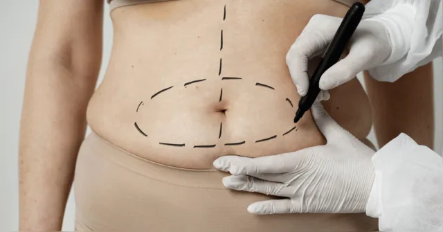 Imagem ilustrativa da notícia Webinar Dr. Responde esclarece dúvidas sobre cirurgia bariátrica e metabólica