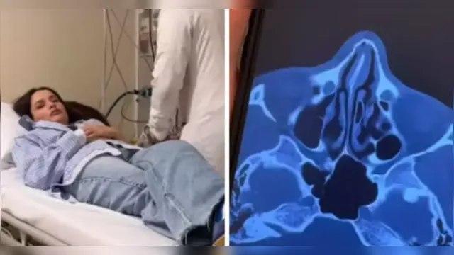 Imagem ilustrativa da notícia Juliette fratura o nariz após acidente doméstico: "Meio torto"