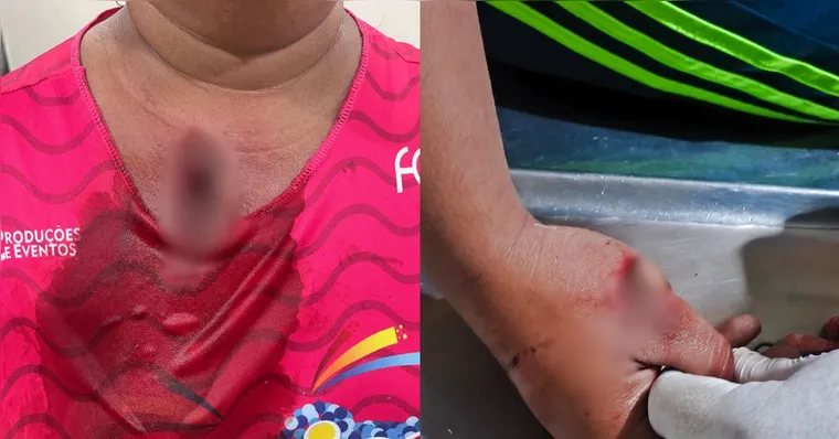 Imagem ilustrativa da notícia Briga por som alto termina com machadadas em mãe e filha
