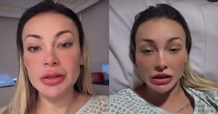 Imagem ilustrativa da notícia Após ser internada, Andressa Urach revela diagnóstico de doença