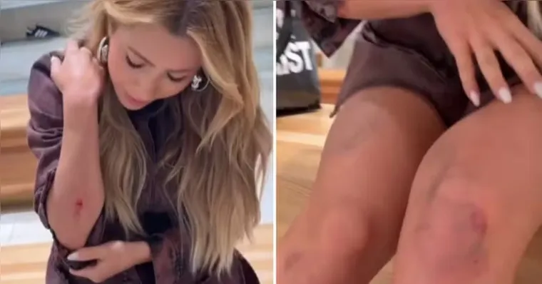 Imagem ilustrativa da notícia Jade Picon cai em Los Angeles e tranquiliza fãs no Brasil