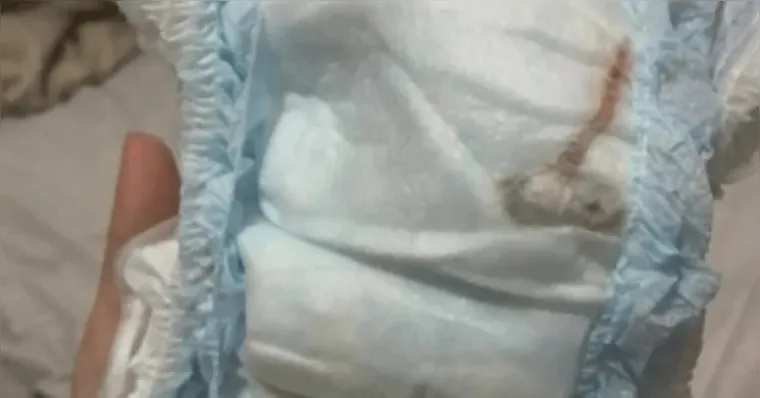 Imagem ilustrativa da notícia Mãe encontra rato morto dentro de fralda lacrada e choca web