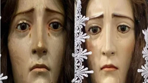 Harmonização facial também em imagem