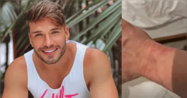 Lucas Viana exibe marcas no braço após ser detido em Dubai e emociona fãs com pedido de orações nas redes sociais.