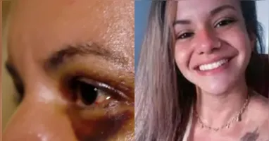 Ex-jogador de basquete agressor deixou marcas físicas e psicológicas na vítima