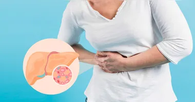 Veja quais alimentos favorecem a saúde do fígado e quais devem ser evitados para prevenir ou tratar a esteatose hepática.