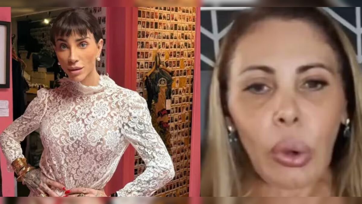 Essas são as cirurgias bizarras de famosos que viraram polêmica