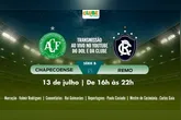 Imagem ilustrativa da notícia TEM JOGO NO DOL E NA CLUBE: Ouça Chapecoense x Clube do Remo