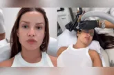 Diferentemente do que muitos podem imaginar, o procedimento não envolve a aplicação direta do esperma do peixe no rosto.