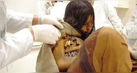 'A Donzela', uma das crianças de Llullaillaco, sacrificada durante um antigo ritual inca e encontrada bem preservada