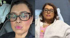 A cantora luta contra um câncer nos Estados Unidos